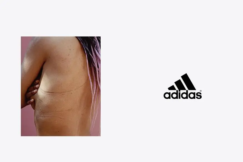 Adidas campaign